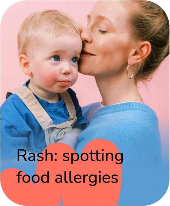 Rash: spotting food allergies